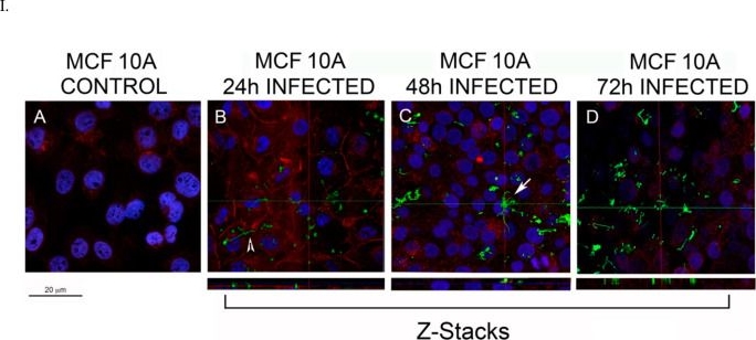 Fig.1.I from the publication: Effect of Invasion of Borrelia burgdorferi in Normal and Neoplastic Mammary Epithelial Cells.