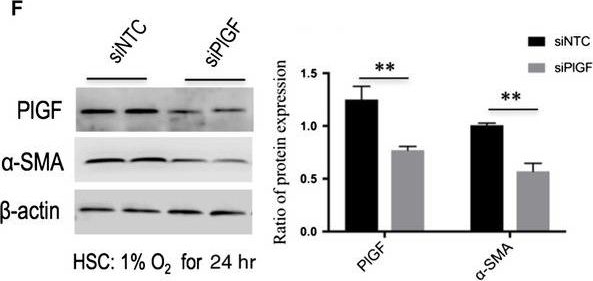 Fig.7.F showing Western Blotting in a Rattus norvegicus (Rat) sample from the publication: Placental growth factor silencing ameliorates liver fibrosis and angiogenesis and inhibits activation of hepatic stellate cells in a murine model of chronic liver disease.