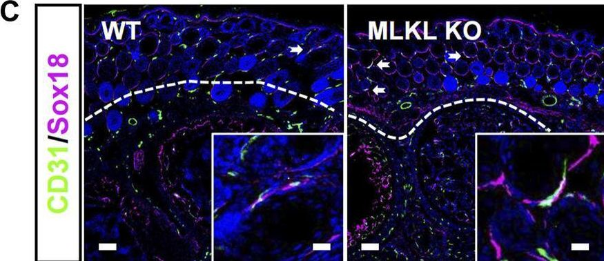 Fig.4.C showing Immunohistochemistry-immunofluorescence in a Mus musculus (House mouse) sample from the publication: Evidence for developmental vascular-associated necroptosis and its contribution to venous-lymphatic endothelial differentiation.
