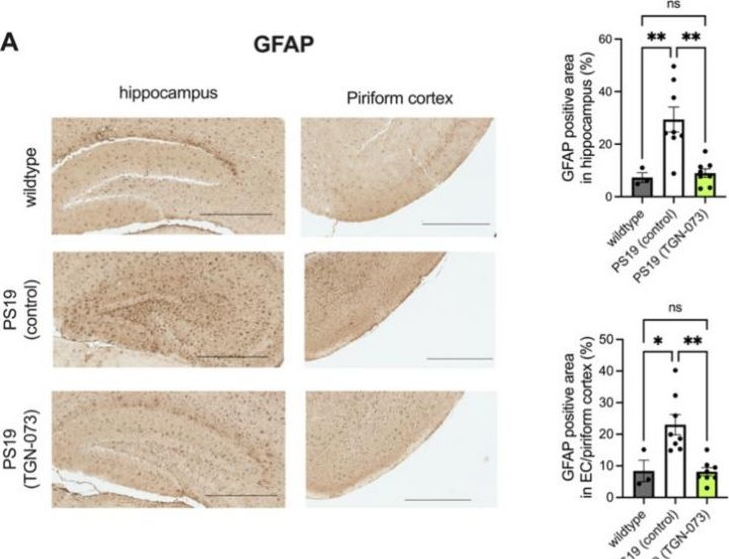 Fig.5.A showing Immunohistochemistry in a Mus musculus (House mouse) sample from the publication: AQP4-dependent enhancement of glymphatic function attenuates tau pathology and neurodegeneration in PS19 mice.