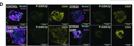 Fig.8.D showing Immunohistochemistry-immunofluorescence in a Mus musculus (House mouse) sample from the publication: Prenatal stress induces changes in PAR2- and M3-dependent regulation of colon primitive cells.