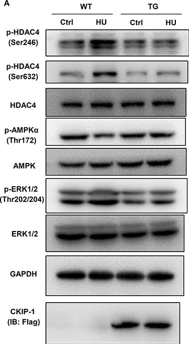 Fig.5.A showing Western Blotting in a Mus musculus (House mouse) sample from the publication: Myocardial CKIP-1 Overexpression Protects from Simulated Microgravity-Induced Cardiac Remodeling.