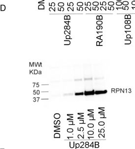 Fig.2.D showing Western Blotting in a Homo sapiens (Human) sample from the publication: Development and anticancer properties of Up284, a spirocyclic candidate ADRM1/RPN13 inhibitor.