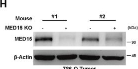 Fig.5.H showing Western Blotting from the publication: The mediator subunit complex protein MED15 promotes lipid deposition and cancer progression during hypoxia.