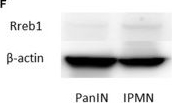 Fig.4.F showing Western Blotting in a Mus musculus (House mouse) sample from the publication: Promoter-Level Transcriptome Identifies Stemness Associated With Relatively High Proliferation in Pancreatic Cancer Cells.