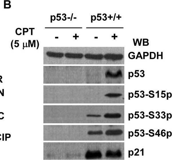 Fig.5.B showing Western Blotting in a Homo sapiens (Human) sample from the publication: Negative Regulation of p21Waf1/Cip1 by Human INO80 Chromatin Remodeling Complex Is Implicated in Cell Cycle Phase G2/M Arrest and Abnormal Chromosome Stability.