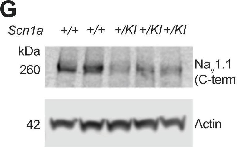 Fig.2.G showing Western Blotting in a Mus musculus (House mouse) sample from the publication: Aberrant regulation of a poison exon caused by a non-coding variant in a mouse model of Scn1a-associated epileptic encephalopathy.