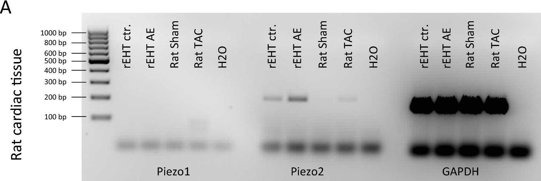 Fig.1.A showing Western Blotting from the publication: Piezo2 is not an indispensable mechanosensor in murine cardiomyocytes.