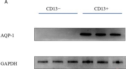 Fig.1.A showing Western Blotting in a Homo sapiens (Human) sample from the publication: tRF-1-ArgTCG-1-1 promotes renal fibrosis by regulating β-catenin.