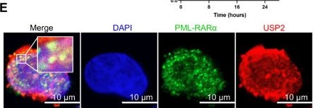 Fig.3.E showing Immunocytochemistry-immunofluorescence from the publication: Targeting USP2 induces degradation of PML-RARα with or without drug-resistant mutations in acute promyelocytic leukemia.