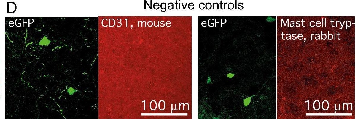 Fig.2.D showing Immunohistochemistry-immunofluorescence in a Rattus norvegicus (Rat) sample from the publication: An efficient rAAV vector for protein expression in cortical parvalbumin expressing interneurons.