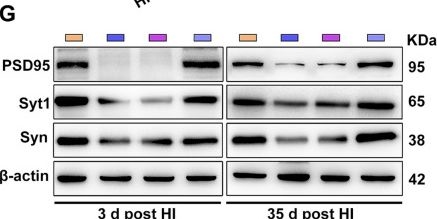 Fig.2.G showing Western Blotting in a Mus musculus (House mouse) sample from the publication: Engineered Extracellular Vesicles Loaded with MiR-100-5p Antagonist Selectively Target the Lesioned Region to Promote Recovery from Brain Damage.