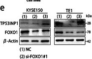 Fig.7.E showing Western Blotting in a Homo sapiens (Human) sample from the publication: STK3 kinase activation inhibits tumor proliferation through FOXO1-TP53INP1/P21 pathway in esophageal squamous cell carcinoma.