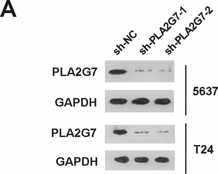 Fig.2.A showing Western Blotting in a Homo sapiens (Human) sample from the publication: PLA2G7 promotes immune evasion of bladder cancer through the JAK-STAT-PDL1 axis.