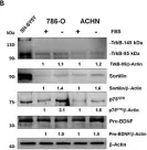 Fig.3.B showing Western Blotting from the publication: p75 neurotrophin receptor and pro-BDNF promote cell survival and migration in clear cell renal cell carcinoma.