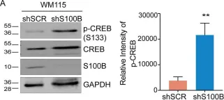 Fig.6.A showing Western Blotting from the publication: The calcium-binding protein S100B reduces IL6 production in malignant melanoma via inhibition of RSK cellular signaling.