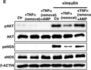Fig.6.E showing Western Blotting from the publication: Ganglioside GM1 contributes to extracellular/intracellular regulation of insulin resistance, impairment of insulin signaling and down-stream eNOS activation, in human aortic endothelial cells after short- or long-term exposure to TNFα.