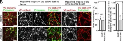 Fig.2.B showing Immunohistochemistry-immunofluorescence from the publication: An Adaptor Molecule Afadin Regulates Lymphangiogenesis by Modulating RhoA Activity in the Developing Mouse Embryo.