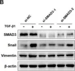 Fig.4.B showing Western Blotting in a Homo sapiens (Human) sample from the publication: MiR-135-5p inhibits TGF-β-induced epithelial-mesenchymal transition and metastasis by targeting SMAD3 in breast cancer.