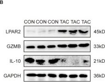 Fig.5.B showing Western Blotting from the publication: Integrated analysis of cell-in-cell related genes and immune microenvironment in heart failure.