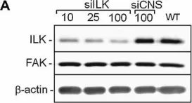 Fig.4.A showing Western Blotting from the publication: Integrin-linked kinase regulates migration and proliferation of human intestinal cells under a fibronectin-dependent mechanism.