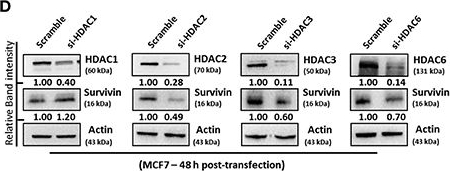 Fig.3.D showing Western Blotting in a Homo sapiens (Human) sample from the publication: Inhibition of HDAC3- and HDAC6-Promoted Survivin Expression Plays an Important Role in SAHA-Induced Autophagy and Viability Reduction in Breast Cancer Cells.