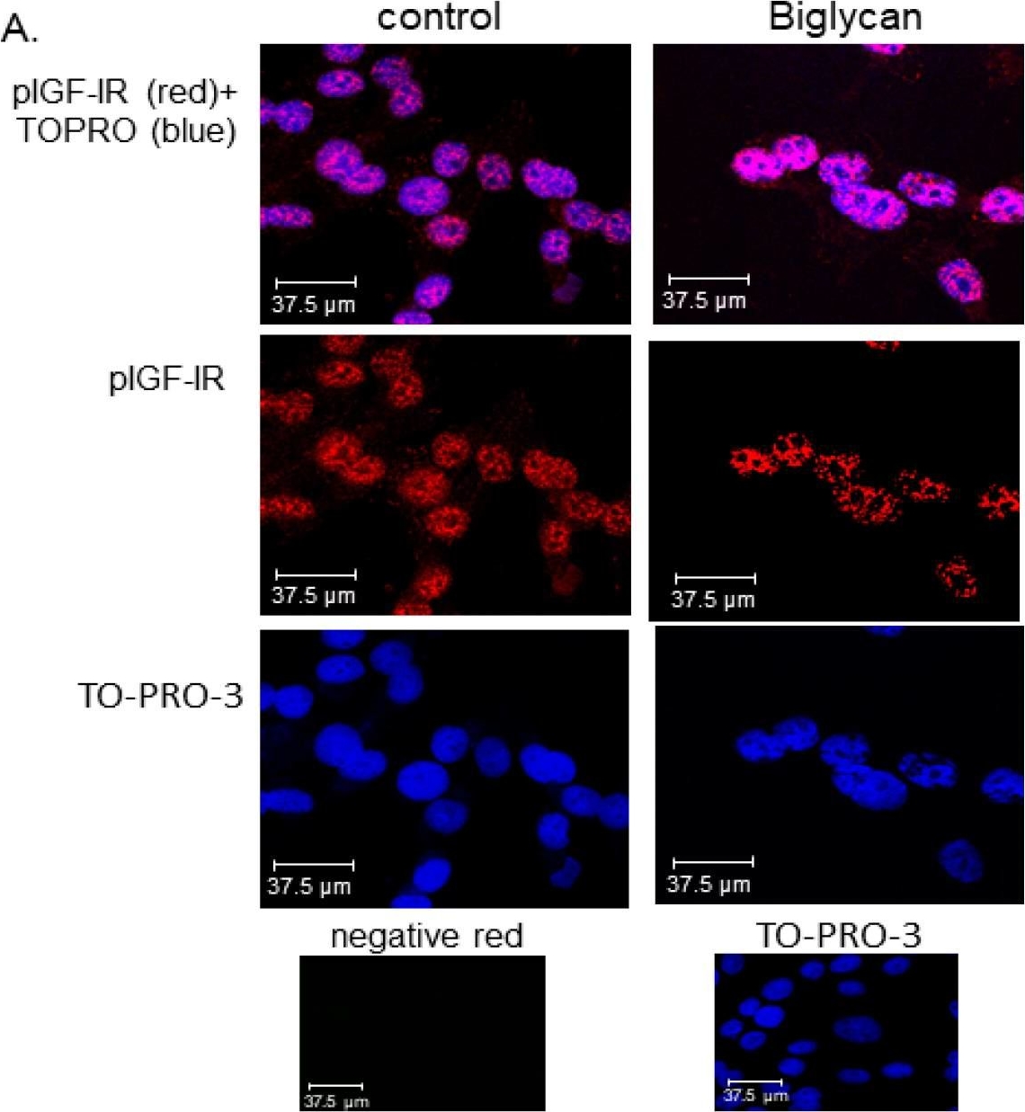Fig.7.A showing Immunocytochemistry-immunofluorescence in a Homo sapiens (Human) sample from the publication: Biglycan Interacts with Type I Insulin-like Receptor (IGF-IR) Signaling Pathway to Regulate Osteosarcoma Cell Growth and Response to Chemotherapy.