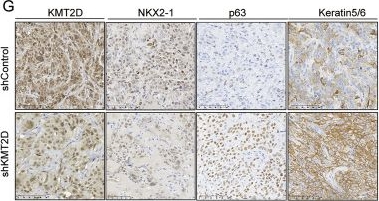 Fig.2.G showing Immunohistochemistry from the publication: KMT2D loss drives adeno-to-squamous transition and sensitizes TKI-resistant lung cancer to AURKA inhibition.