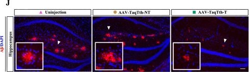 Fig.5.J showing Immunohistochemistry-immunofluorescence from the publication: TaqTth-hpRNA: a novel compact RNA-targeting tool for specific silencing of pathogenic mRNA.
