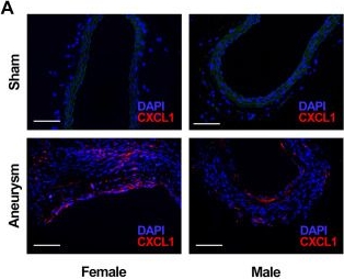 Fig.1.A showing Immunohistochemistry-immunofluorescence in a Mus musculus (House mouse) sample from the publication: CXCL1: a novel therapeutic target to increase aneurysm healing after coil embolization.