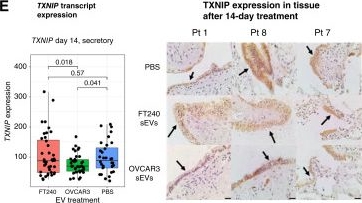 Fig.7.E showing Immunohistochemistry from the publication: Defining the Ovarian Cancer Precancerous Landscape through Modeling Fallopian Tube Epithelium Reprogramming Driven by Extracellular Vesicles.