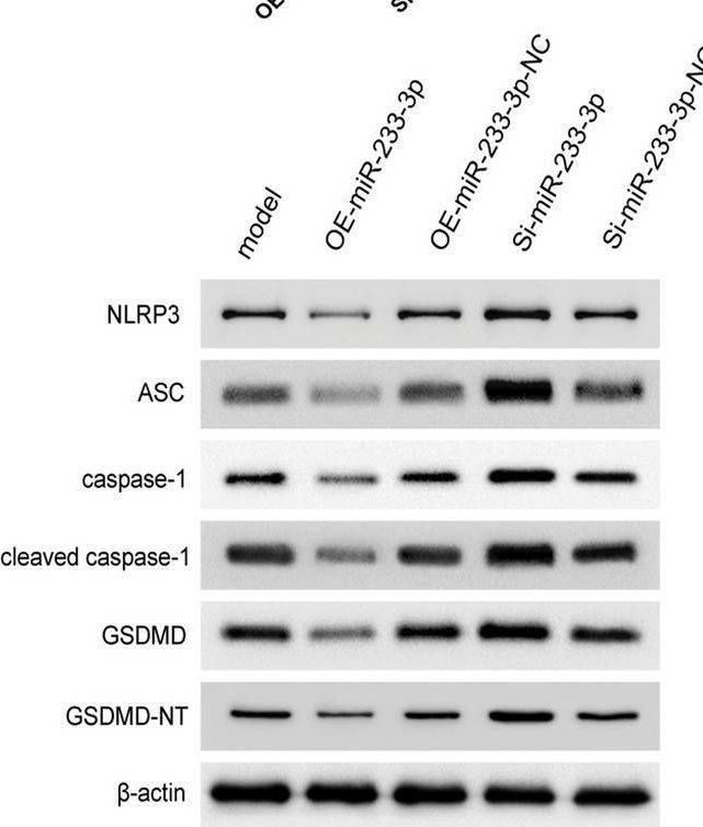 Fig.4.O showing Western Blotting in a Homo sapiens (Human) sample from the publication: Investigation of the mechanism by which miR-223-3p inhibits reflux esophagitis through targeting the NLRP3 inflammasome.