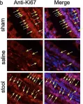 Fig.6.B showing Immunohistochemistry in a Rattus norvegicus (Rat) sample from the publication: A new murine ileostomy model: recycling stool prevents intestinal atrophy in the distal side of ileostomy.