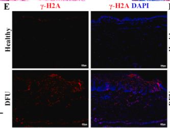 Fig.1.E showing Immunohistochemistry-immunofluorescence in a Mus musculus (House mouse) sample from the publication: Senolytic-loaded asymmetric wound dressing for targeted senescent cell clearance in diabetic wound healing.