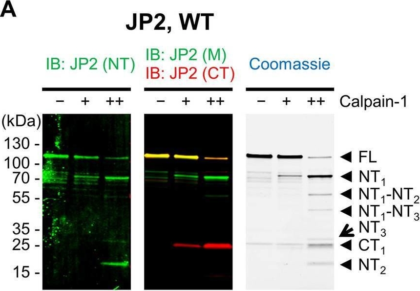 Fig.2.A showing Western Blotting from the publication: Calpain cleavage of Junctophilin-2 generates a spectrum of calcium-dependent cleavage products and DNA-rich NT1-fragment domains in cardiomyocytes.