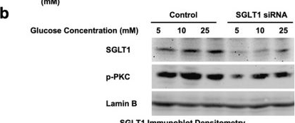 Fig.7.B showing Western Blotting from the publication: Cardiac sodium-glucose co-transporter 1 (SGLT1) contributes to heart failure in a mouse model of diabetic cardiomyopathy.