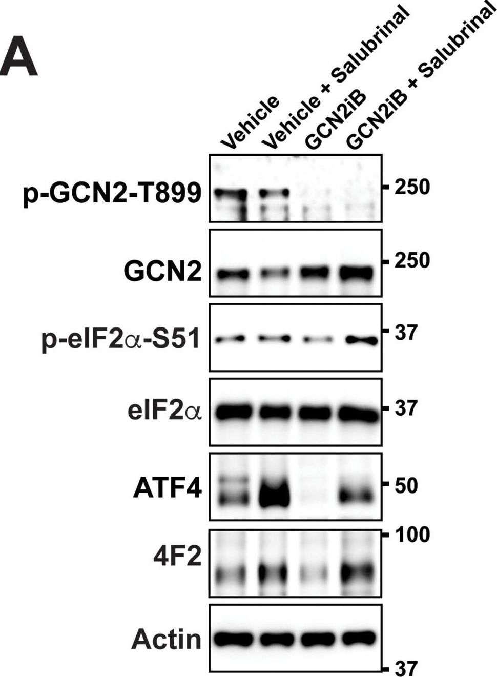 Fig.4.A showing Western Blotting from the publication: GCN2 eIF2 kinase promotes prostate cancer by maintaining amino acid homeostasis.
