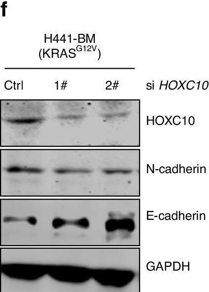 Fig.4.T showing Western Blotting from the publication: The HOXC10/NOD1/ERK axis drives osteolytic bone metastasis of pan-KRAS-mutant lung cancer.