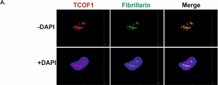 Fig.1.A showing Immunocytochemistry-immunofluorescence in a Homo sapiens (Human) sample from the publication: TCOF1 affects Golgi secretory pathway contributing to the angiogenesis in renal cancer.