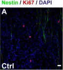 Fig.2.A showing Immunocytochemistry in a Rattus norvegicus (Rat) sample from the publication: A Strategy for Magnetic and Electric Stimulation to Enhance Proliferation and Differentiation of NPCs Seeded over PLA Electrospun Membranes.