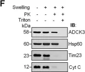 Fig.1.F showing Western Blotting from the publication: AarF Domain Containing Kinase 3 (ADCK3) Mutant Cells Display Signs of Oxidative Stress, Defects in Mitochondrial Homeostasis and Lysosomal Accumulation.