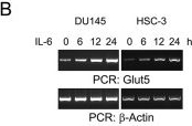 Fig.2.B showing Western Blotting in a Mus musculus (House mouse) sample from the publication: IL-6/STAT3 Axis Activates Glut5 to Regulate Fructose Metabolism and Tumorigenesis.