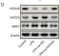 Fig.6.D showing Western Blotting in a Mus musculus (House mouse) sample from the publication: HOXA5 Suppresses NEK7-Mediated Alveolar Epithelial Pyroptosis in Acute Lung Injury by Transcriptionally Inhibiting KAT2A.