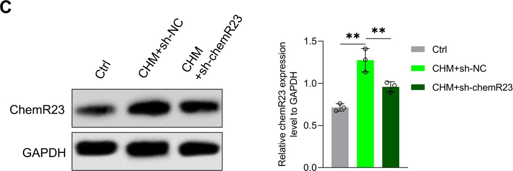 Fig.3.C showing Western Blotting from the publication: Chemerin-Induced Down-Regulation of Placenta-Derived Exosomal miR-140-3p and miR-574-3p Promotes Umbilical Vein Endothelial Cells Proliferation, Migration, and Tube Formation in Gestational Diabetes Mellitus.