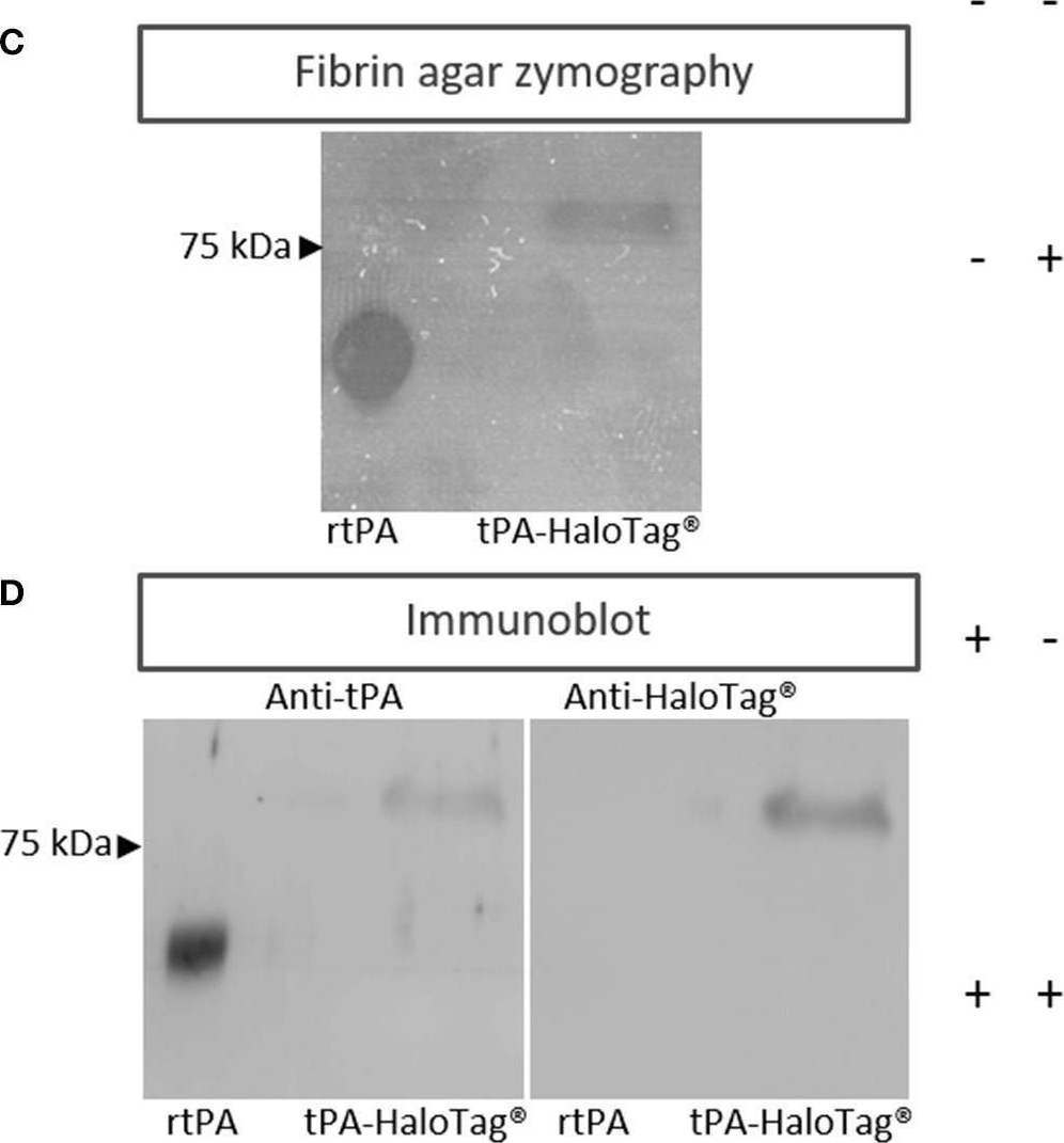 Fig.1.C showing Western Blotting in a Homo sapiens (Human) sample from the publication: Post-synaptic Release of the Neuronal Tissue-Type Plasminogen Activator (tPA).