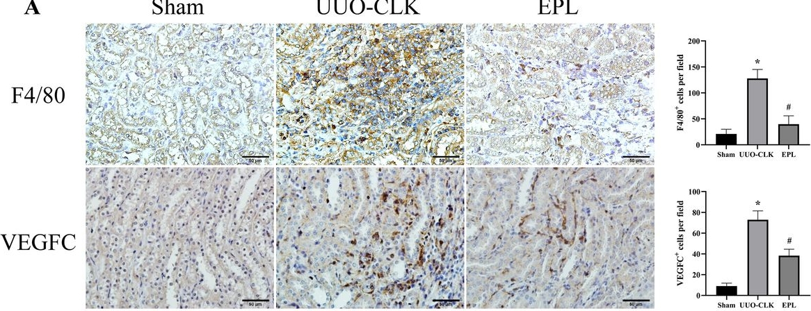 Fig.3.A showing Immunohistochemistry from the publication: Eplerenone reduces lymphangiogenesis in the contralateral kidneys of UUO rats.