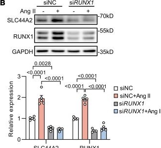 Fig.7.B showing Western Blotting from the publication: SLC44A2 regulates vascular smooth muscle cell phenotypic switching and aortic aneurysm.