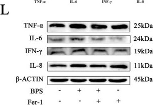 Fig.6.L showing Western Blotting from the publication: Gestational and Lactational Exposure to BPS Triggers Microglial Ferroptosis via the SLC7A11/GPX4 Antioxidant Axis and Induces Memory Impairment in Offspring Mice.