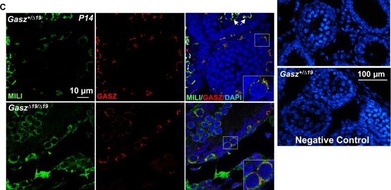 Fig.3.C showing Immunohistochemistry-immunofluorescence from the publication: GASZ directly recruits MILI to the intermitochondrial cement for piRNA biogenesis and male germ cell development.