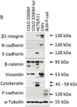 Fig.2.B showing Western Blotting from the publication: Age and cellular context influence rectal prolapse formation in mice with caecal wall colorectal cancer xenografts.